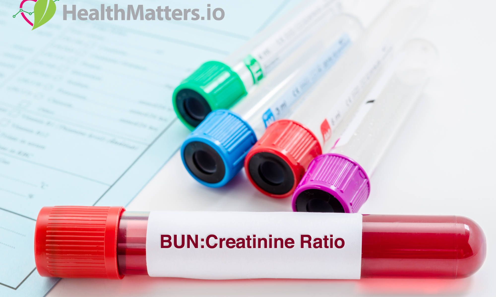 blood urea nitrogen creatinine ration meaning high low reference value definition